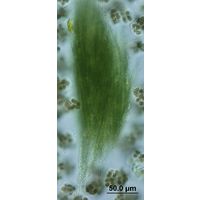 Aphanizomenon
