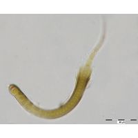 Calothrix parietina
