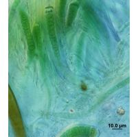Calothrix contrarenii