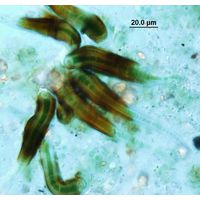 Calothrix scopulorum