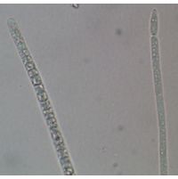 Cylindrospermopsis raciborskii