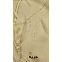 Cylindrospermum muscicola