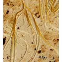 Dichothrix ledereri