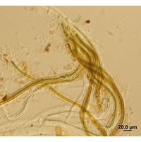 Dichothrix ledereri