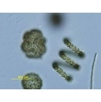 Dolichoslermum crassum