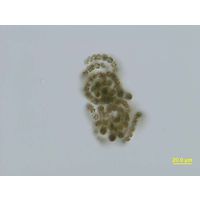 Dolichospermum flos-aquae