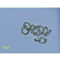 Dolichospermum flos-aquae
