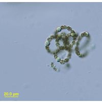 Dolichospermum flos-aquae