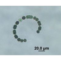 Dolichospermum flos-aquae