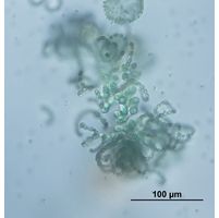 Dolichospermum lemmermannii