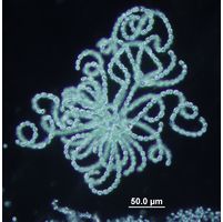 Dolichospermum lemmermannii