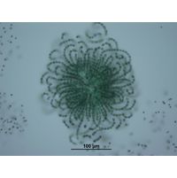 Dolichospermum lemmermannii