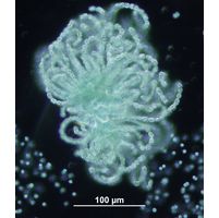 Dolichospermum lemmermannii