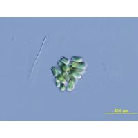 Dolichospermum lemmermannii