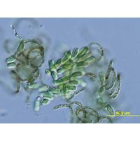 Dolichospermum lemmermannii