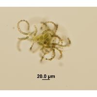Dolichospermum lemmermanii