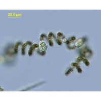 Dolichospermum spiroides
