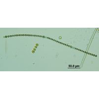 Dolichospermum