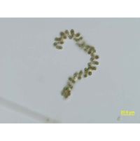 Dolichospermum compactum