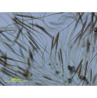 Gloeotrichia natans