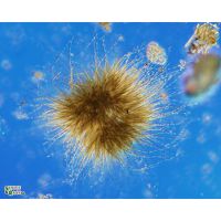 Gloeotrichia echinulata