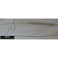Gloeotrichia intermedia