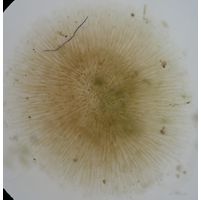 Gloeotrichia