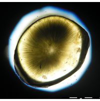 Gloeotrichia intermedia