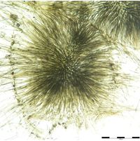 Gloeotrichia intermedia