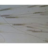 Gloeotrichia sp.