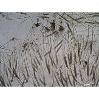 Gloeotrichia sp.