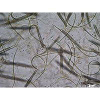 Gloeotrichia sp.