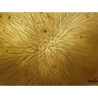 Gloeotrichia sp.