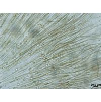 Gloeotrichia sp.