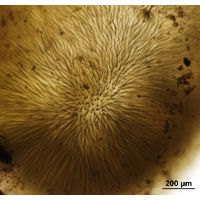 Gloeotrichia sp.
