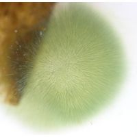 Gloeotrichia sp.
