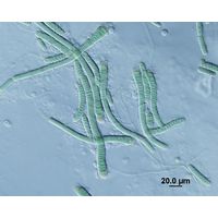 Microchaete sp. 