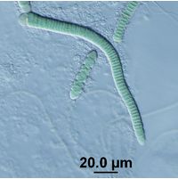Microchaete sp.