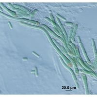 Microchaete sp.