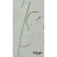 Nodularia harveyana