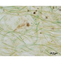 Nodularia harveyana