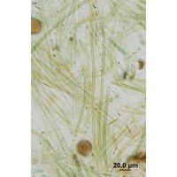 Nodularia harveyana