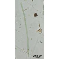 Nodularia harveyana