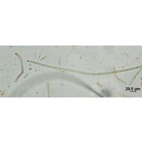 Nodularia harveyana