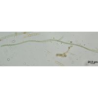 Nodularia harveyana