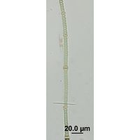 Nodularia harveyana