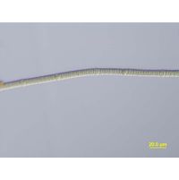 Nodularia