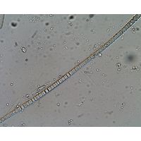Nodularia moravica