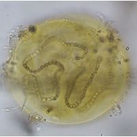 Nostoc planctonicum