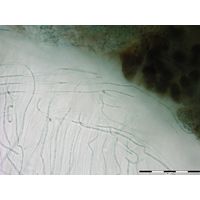Nostochopsis lobatus